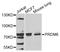 PR/SET Domain 6 antibody, STJ110156, St John