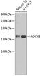 Adenylate cyclase type 8 antibody, 19-093, ProSci, Western Blot image 