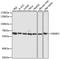 Sterol Regulatory Element Binding Transcription Factor 2 antibody, LS-C748110, Lifespan Biosciences, Western Blot image 