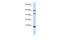 Diazepam Binding Inhibitor, Acyl-CoA Binding Protein antibody, NBP1-54806, Novus Biologicals, Western Blot image 