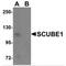 Signal Peptide, CUB Domain And EGF Like Domain Containing 1 antibody, MBS151427, MyBioSource, Western Blot image 