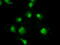 TYRO3 Protein Tyrosine Kinase antibody, M00913-3, Boster Biological Technology, Immunofluorescence image 
