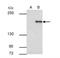 SET Domain Bifurcated Histone Lysine Methyltransferase 1 antibody, NBP2-20322, Novus Biologicals, Immunoprecipitation image 