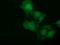 NSE2 (MMS21) Homolog, SMC5-SMC6 Complex SUMO Ligase antibody, GTX83996, GeneTex, Immunocytochemistry image 