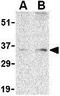 BCL2 Associated Athanogene 1 antibody, GTX31737, GeneTex, Western Blot image 