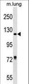 Retinol Binding Protein 3 antibody, LS-C158828, Lifespan Biosciences, Western Blot image 