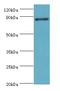 ADA33 antibody, LS-C379289, Lifespan Biosciences, Western Blot image 