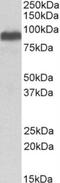 Itchy E3 Ubiquitin Protein Ligase antibody, NB100-68142, Novus Biologicals, Western Blot image 