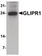 GLI Pathogenesis Related 1 antibody, PA5-38023, Invitrogen Antibodies, Western Blot image 