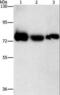 Adenosine Monophosphate Deaminase 1 antibody, LS-C402884, Lifespan Biosciences, Western Blot image 