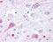 Glutamate Metabotropic Receptor 2 antibody, 48-303, ProSci, Immunohistochemistry paraffin image 