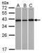 Vesicle Trafficking 1 antibody, TA308412, Origene, Western Blot image 