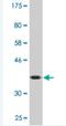 Eukaryotic Translation Initiation Factor 1A Y-Linked antibody, H00009086-M03, Novus Biologicals, Western Blot image 