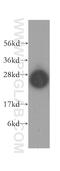 Syntaxin 8 antibody, 12206-1-AP, Proteintech Group, Western Blot image 