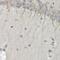 Proteasome Subunit Beta 10 antibody, GTX32818, GeneTex, Immunohistochemistry paraffin image 