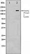 Platelet Derived Growth Factor Receptor Alpha antibody, orb106069, Biorbyt, Western Blot image 
