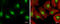E2F-1 antibody, GTX101235, GeneTex, Immunofluorescence image 
