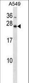 Homeobox B7 antibody, LS-B11207, Lifespan Biosciences, Western Blot image 