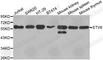 ETS Variant 6 antibody, A1637, ABclonal Technology, Western Blot image 