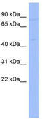 Ring Finger Protein 14 antibody, TA343453, Origene, Western Blot image 