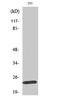 MOB Kinase Activator 1B antibody, STJ94175, St John