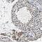 Nanos C2HC-Type Zinc Finger 2 antibody, NBP2-13638, Novus Biologicals, Immunohistochemistry paraffin image 