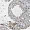 NANOS2 antibody, NBP2-13638, Novus Biologicals, Immunohistochemistry paraffin image 