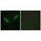 Phosphorylase Kinase Regulatory Subunit Alpha 1 antibody, A10086, Boster Biological Technology, Immunofluorescence image 