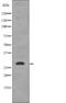 Stratifin antibody, PA5-64811, Invitrogen Antibodies, Western Blot image 
