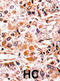 Cyclin-dependent kinase inhibitor 2A, isoforms 1/2/3 antibody, abx031885, Abbexa, Immunohistochemistry frozen image 