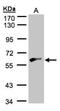 Glycerol Kinase 2 antibody, NBP1-32210, Novus Biologicals, Western Blot image 