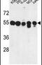 Protein Phosphatase, Mg2+/Mn2+ Dependent 1H antibody, PA5-26102, Invitrogen Antibodies, Western Blot image 