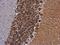 Calcium/Calmodulin Dependent Protein Kinase II Beta antibody, GTX133072, GeneTex, Immunohistochemistry paraffin image 