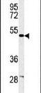 Coronin 6 antibody, PA5-24758, Invitrogen Antibodies, Western Blot image 