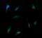 Protein Tyrosine Kinase 2 antibody, NBP2-45923, Novus Biologicals, Immunocytochemistry image 