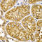Keratin 5 antibody, LS-C335265, Lifespan Biosciences, Immunohistochemistry paraffin image 