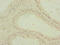 Pyruvate Dehydrogenase E1 Alpha 2 Subunit antibody, LS-C676236, Lifespan Biosciences, Immunohistochemistry paraffin image 