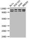 MutS Homolog 2 antibody, orb400604, Biorbyt, Western Blot image 