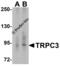 Transient Receptor Potential Cation Channel Subfamily C Member 3 antibody, 8269, ProSci, Western Blot image 
