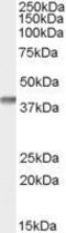 Secreted Frizzled Related Protein 2 antibody, GTX89043, GeneTex, Western Blot image 