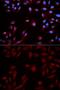 Signal Transducer And Activator Of Transcription 5B antibody, GTX32898, GeneTex, Immunocytochemistry image 