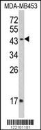 Interferon Gamma Receptor 2 antibody, 62-577, ProSci, Western Blot image 