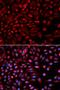 NIMA Related Kinase 2 antibody, LS-C334005, Lifespan Biosciences, Immunofluorescence image 