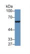 Interleukin 9 Receptor antibody, LS-C374142, Lifespan Biosciences, Western Blot image 