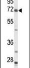 Acyl-CoA Synthetase Short Chain Family Member 2 antibody, PA5-26612, Invitrogen Antibodies, Western Blot image 