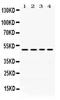 Damage Specific DNA Binding Protein 2 antibody, PA5-79143, Invitrogen Antibodies, Western Blot image 