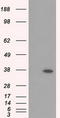 Retinol dehydrogenase 11 antibody, CF501053, Origene, Western Blot image 