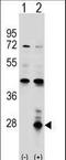 Azurocidin 1 antibody, LS-C156700, Lifespan Biosciences, Western Blot image 