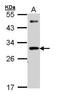 Cell Death Inducing DFFA Like Effector A antibody, GTX113166, GeneTex, Western Blot image 
