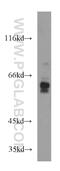 Glyoxylate Reductase 1 Homolog antibody, 14833-1-AP, Proteintech Group, Western Blot image 